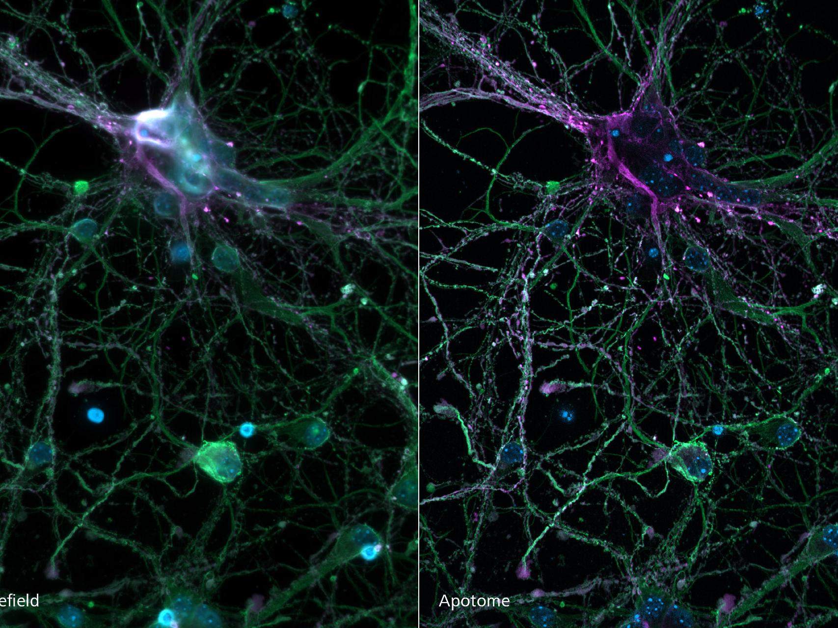 Cortical neurons stained for DNA, microtubules and microtubule-associated proteins.