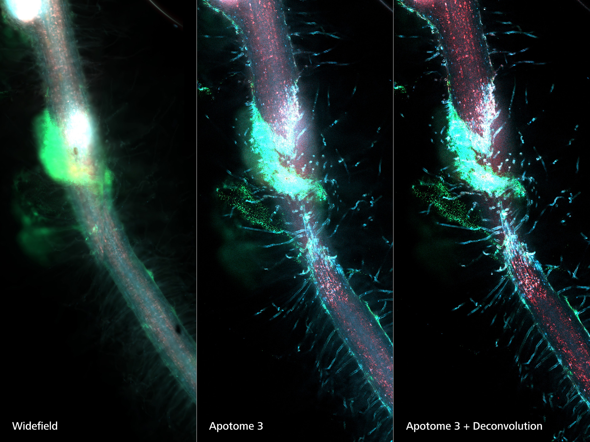 De izquierda a derecha: Widefield, Apotome 3, Apotome 3 + Deconvolución 