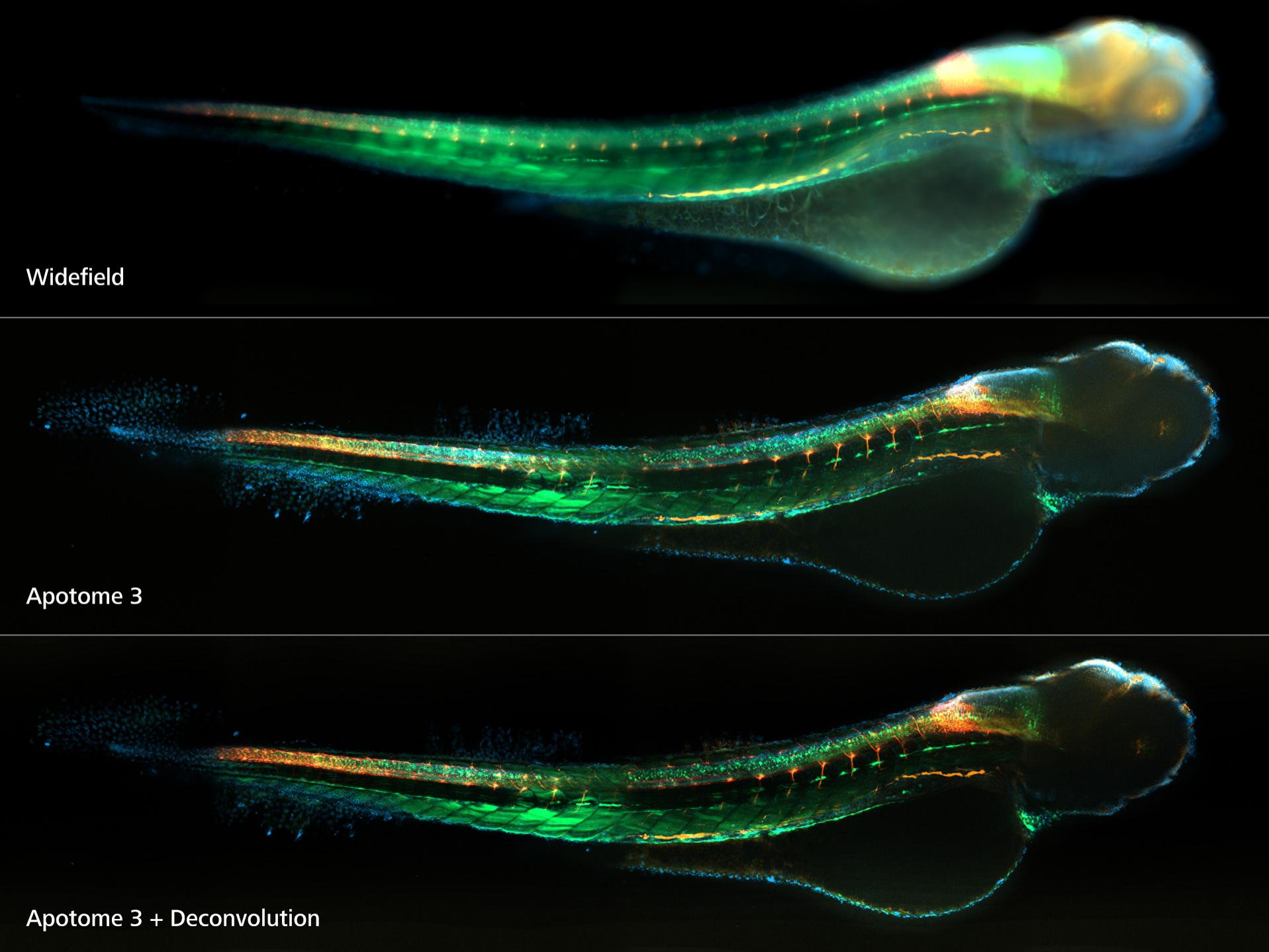 Top to bottom: Widefield, Apotome 3, Apotome 3 + Deconvolution