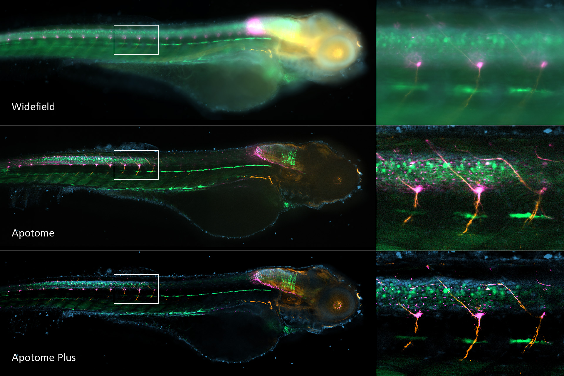 Transgenic zebrafish larvae at 4 days post fertilization staining for: Glial fibrillary acidic protein, acetylated Tubulin, GFP and DNA. Embedded in 1.2% low melt agarose.