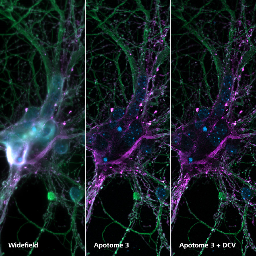 Neurones corticaux. Image 1 - champ large, image 2 - Apotome 3, image 3 - Apotome 3 + DCV  Avec l'aimable autorisation de L. Behrendt, Leibniz-Institute on Aging – Fritz-Lipmann-Institut e.V. (FLI), Allemagne.