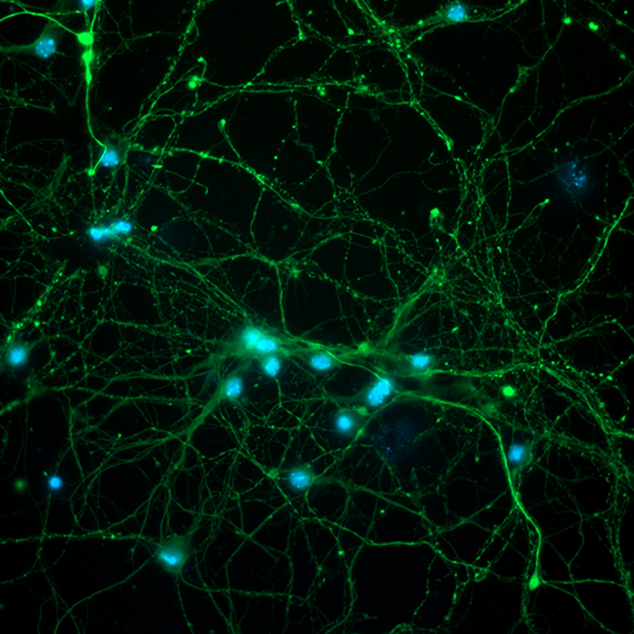 Cortical neurons (left: Widefield; right: Apotome 3). Courtesy of L. Behrendt, Leibniz-Institute on Aging – Fritz-Lipmann-Institut e.V. (FLI), Germany.