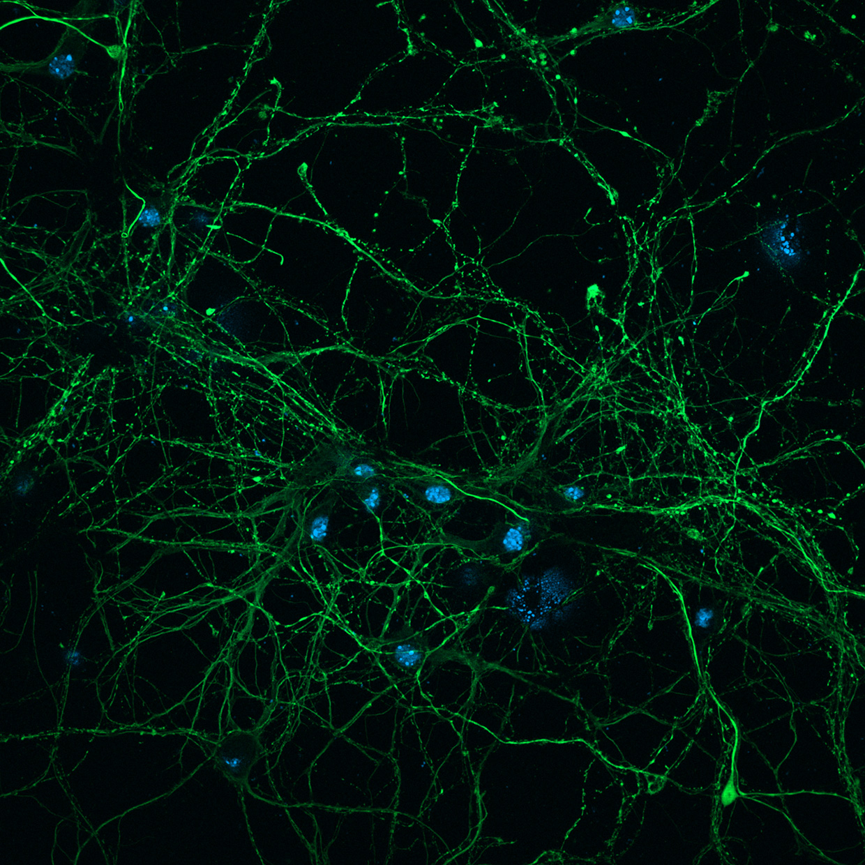 Kortikale Neuronen (links: Weitfeld; rechts: Apotome 3). Mit freundlicher Genehmigung von L. Behrendt, Leibniz-Institut für Alternsforschung – Fritz-Lipmann-Institut e.V. (FLI), Deutschland.