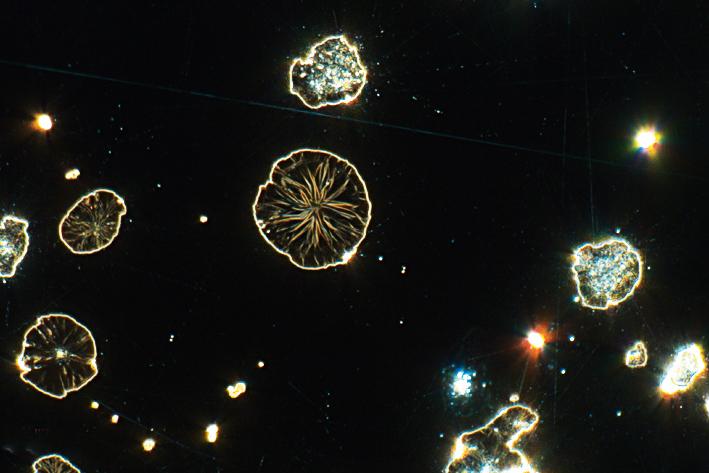 Hierro fundido con grafito esferulítico, muestra pulida, mismo sitio idéntico captado con diferentes técnicas de contraste (campo de visión de 265 µm). Campo oscuro​