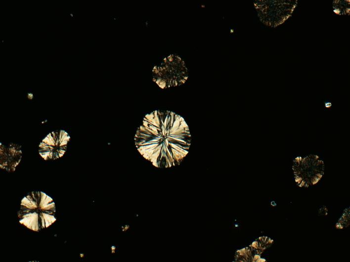 Hierro fundido con grafito esferulítico, muestra pulida, mismo sitio idéntico captado con diferentes técnicas de contraste (campo de visión de 265 µm). Polarización (polarización cruzada)​