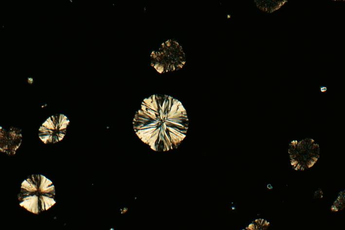 Hierro fundido con grafito esferulítico, muestra pulida, mismo sitio idéntico captado con diferentes técnicas de contraste (campo de visión de 265 µm). Polarización (polarización cruzada)​