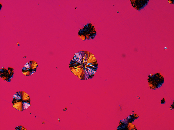 Cast iron with spherulitic graphite, polished sample, identical same site imaged with different contrasting techniques (field of view 265 µm). Polarization with additional lambda compensator 