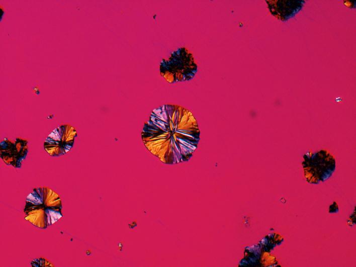 Cast iron with spherulitic graphite, polished sample, identical same site imaged with different contrasting techniques (field of view 265 µm). Polarization with additional lambda compensator