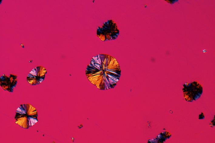 Hierro fundido con grafito esferulítico, muestra pulida, mismo sitio idéntico captado con diferentes técnicas de contraste (campo de visión de 265 µm). Polarización con compensador Lambda adicional