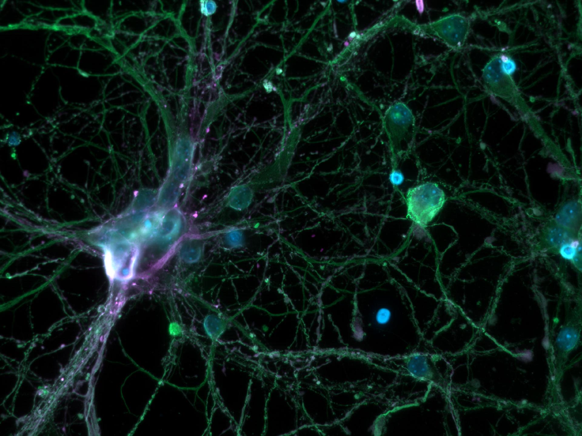 Neuronas corticales. Widefield. Cortesía de L. Behrendt, Leibniz-Institute on Aging – Fritz-Lipmann-Institut e.V. (FLI), Alemania.