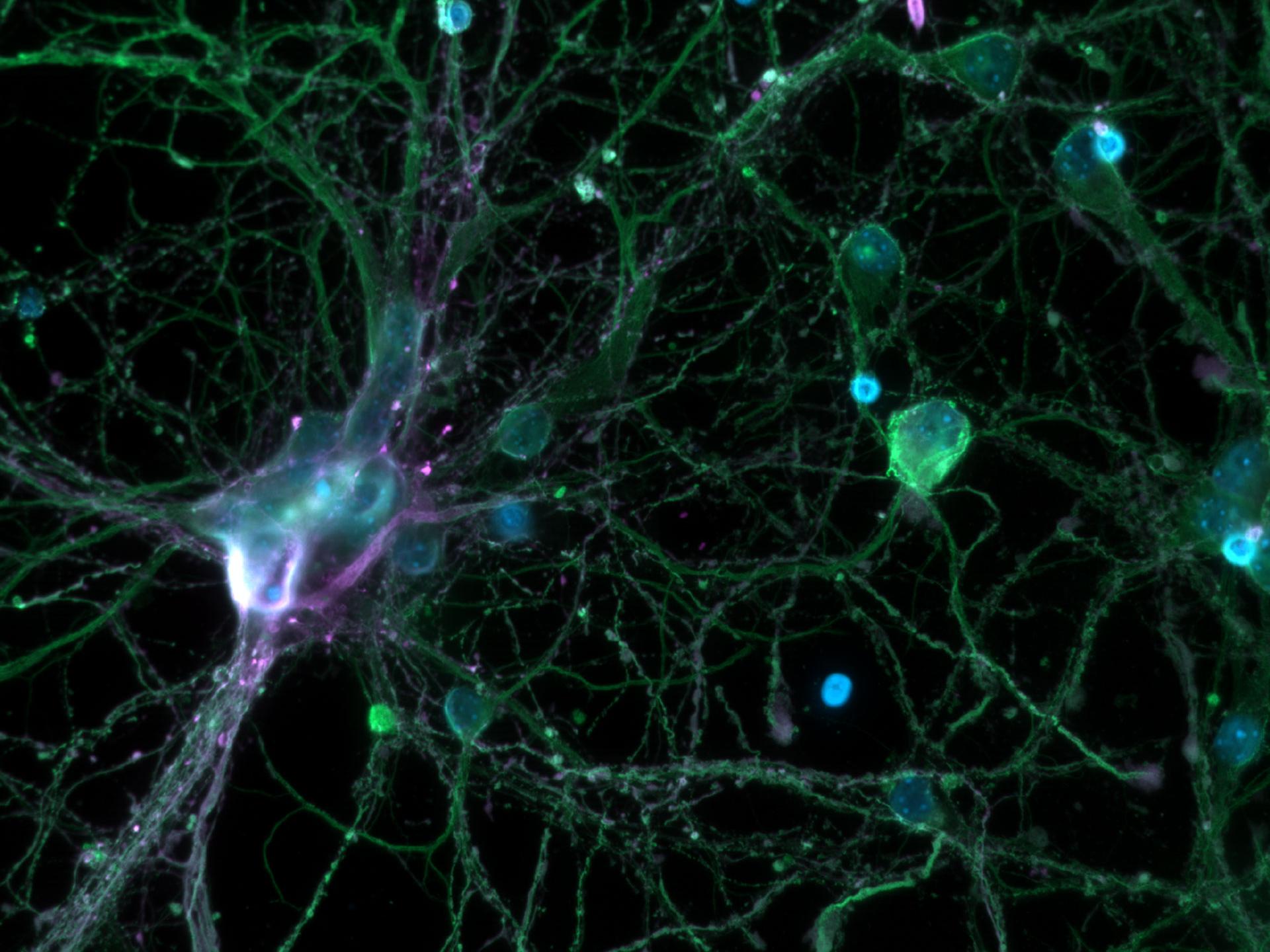 Kortikale Neuronen. Weitfeld. Mit freundlicher Genehmigung von L. Behrendt, Leibniz-Institut für Alternsforschung – Fritz-Lipmann-Institut e.V. (FLI), Deutschland.