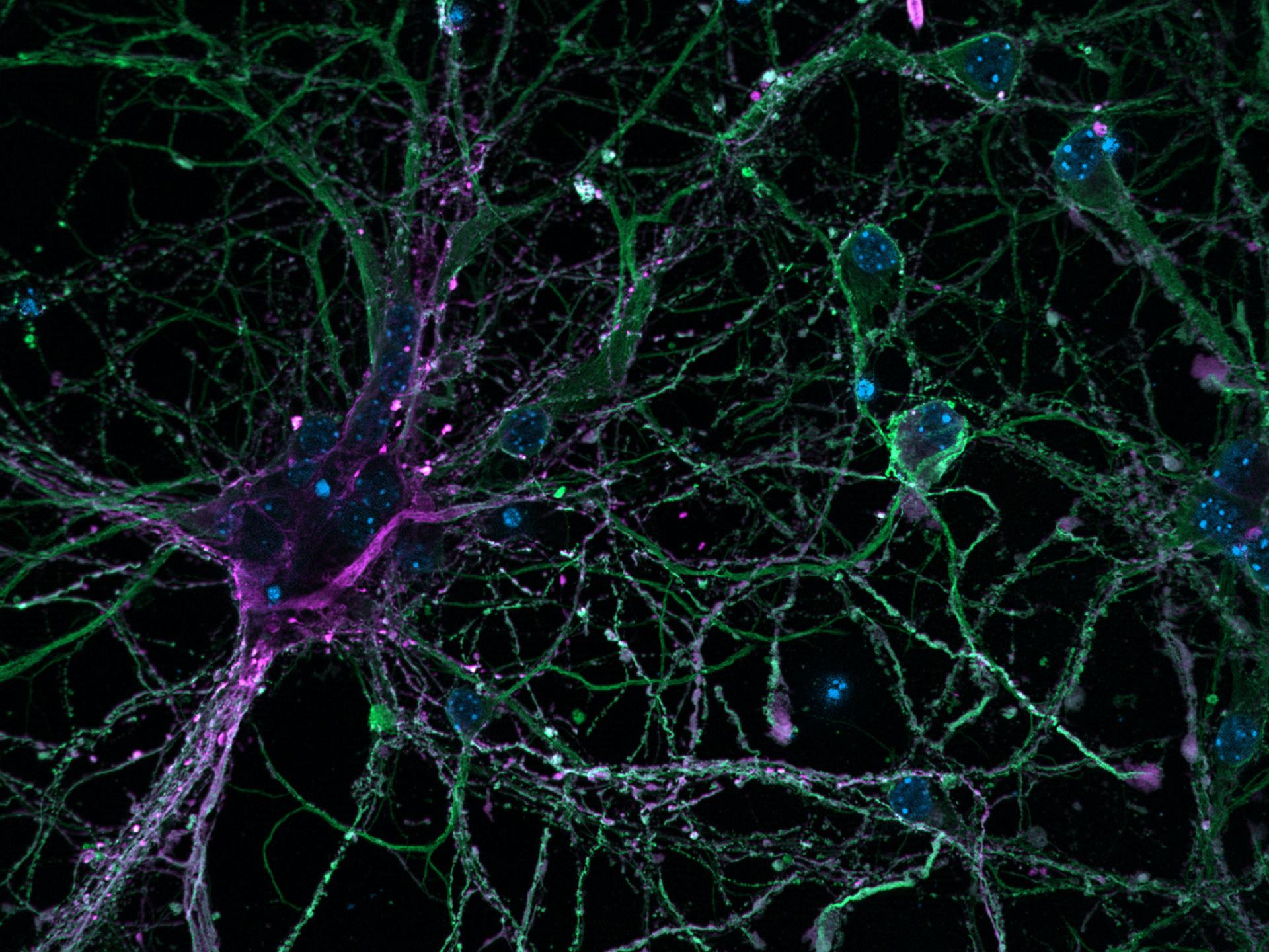 Kortikale Neuronen. Apotome 3. Mit freundlicher Genehmigung von L. Behrendt, Leibniz-Institut für Alternsforschung – Fritz-Lipmann-Institut e.V. (FLI), Deutschland.