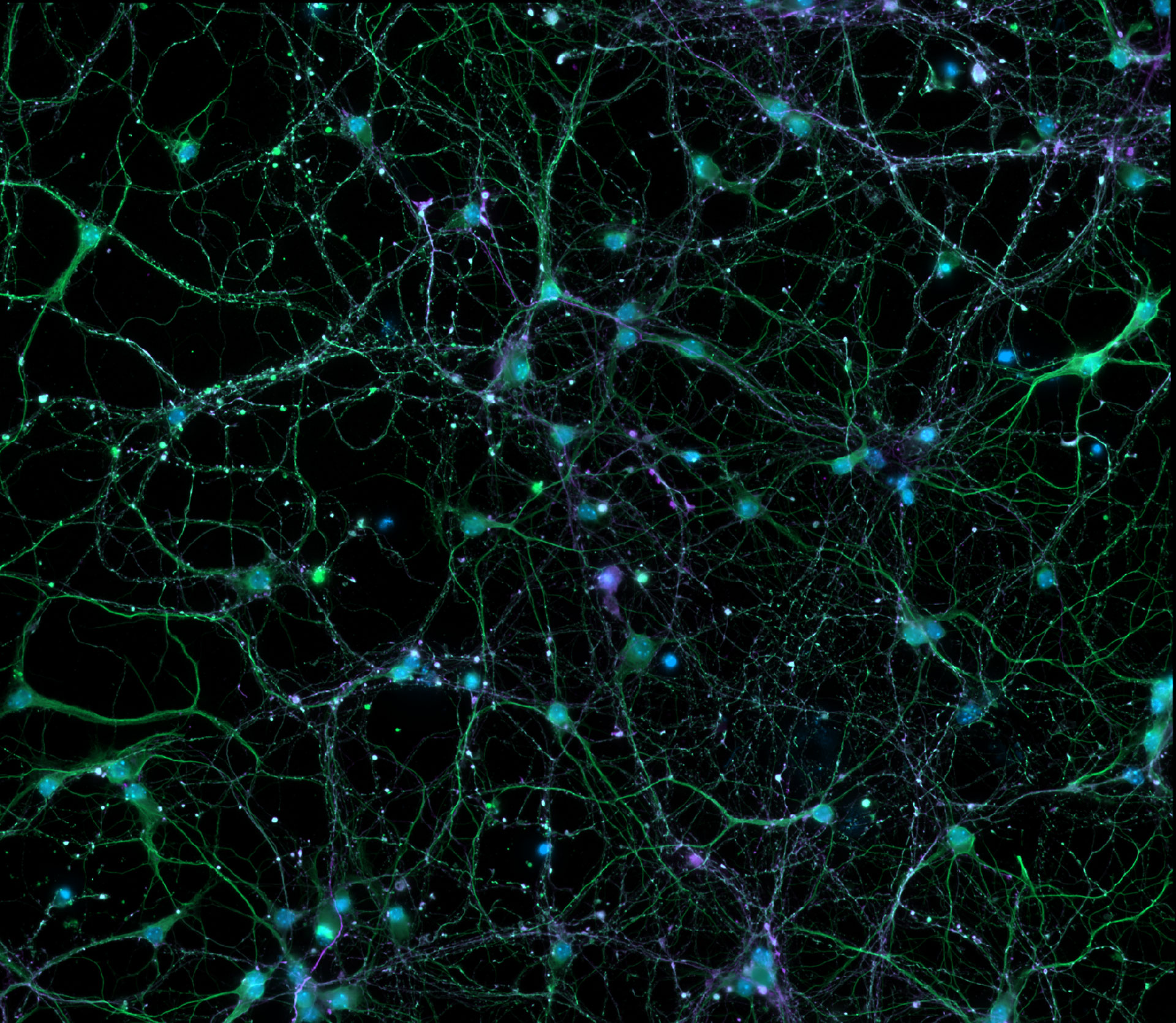 Neuronas corticales teñidas para ADN, microtúbulos y proteínas asociadas a microtúbulos. Cortesía de: Leibniz-Institute on Aging – Fritz-Lipmann-Institut e.V. (FLI), Alemania.  Cortesía de: Leibniz-Institute on Aging – Fritz-Lipmann-Institut e.V. (FLI), Alemania.