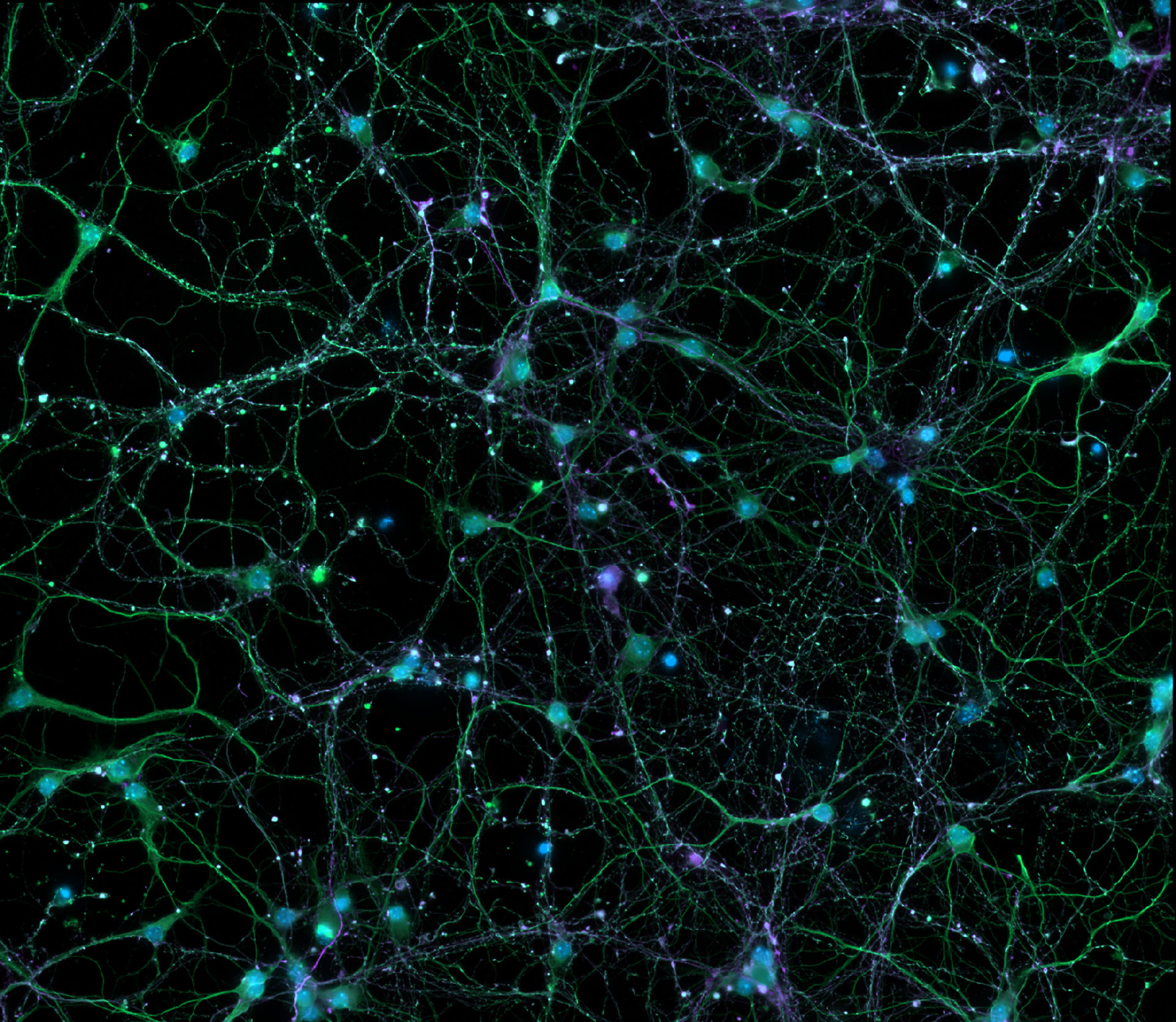 Kortikale Neuronen gefärbt auf DNS, Mikrotubuli und Mikrotubuli-assoziierte Proteine. Mit freundlicher Genehmigung vom Leibniz-Institut für Alternsforschung – Fritz-Lipmann-Institut e.V. (FLI), Deutschland.  Mit freundlicher Genehmigung vom Leibniz-Institut für Alternsforschung – Fritz-Lipmann-Institut e.V. (FLI), Deutschland.