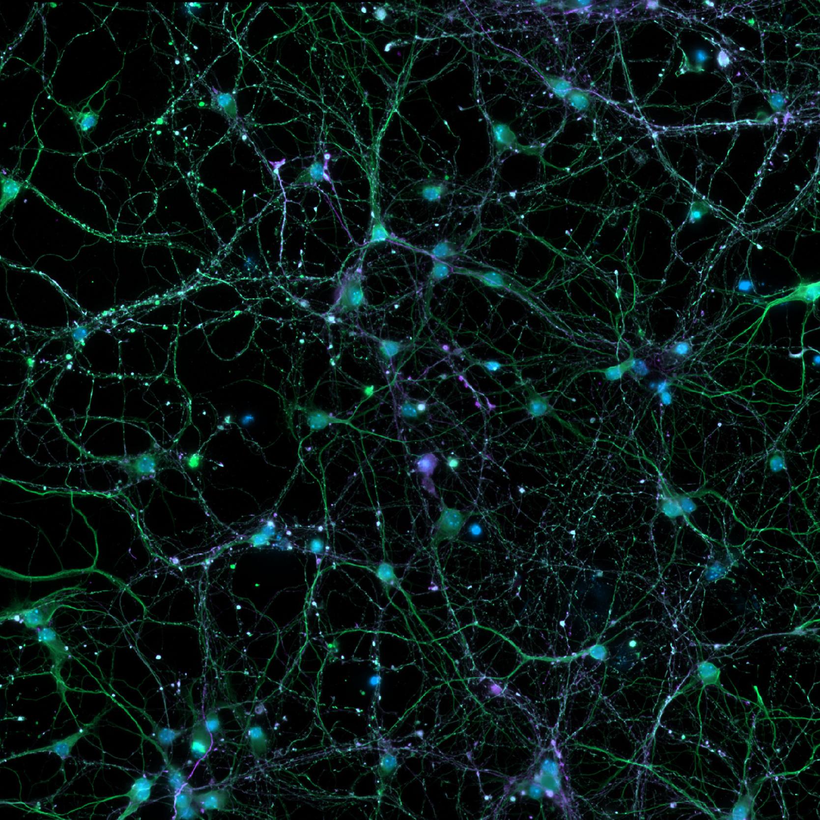 DNA、微小管、微小管結合タンパク質を染色した皮質ニューロン。ご提供：Leibniz-Institute on Aging – Fritz-Lipmann-Institut e.V. (FLI), Germany