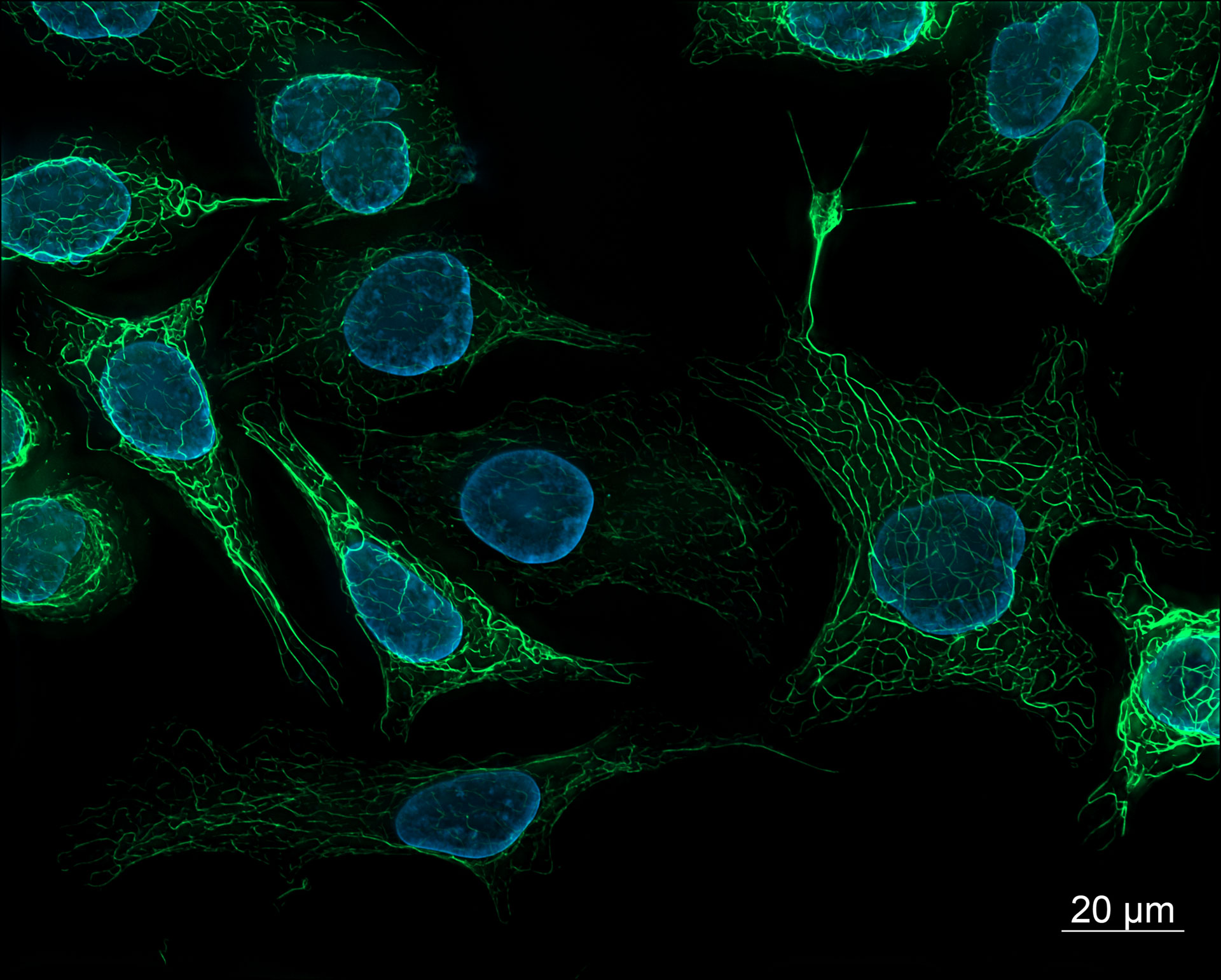SK8/K18マウス細胞。Alexa 488で染色したビメンチン（緑）、DAPIで染色した核（青）。 