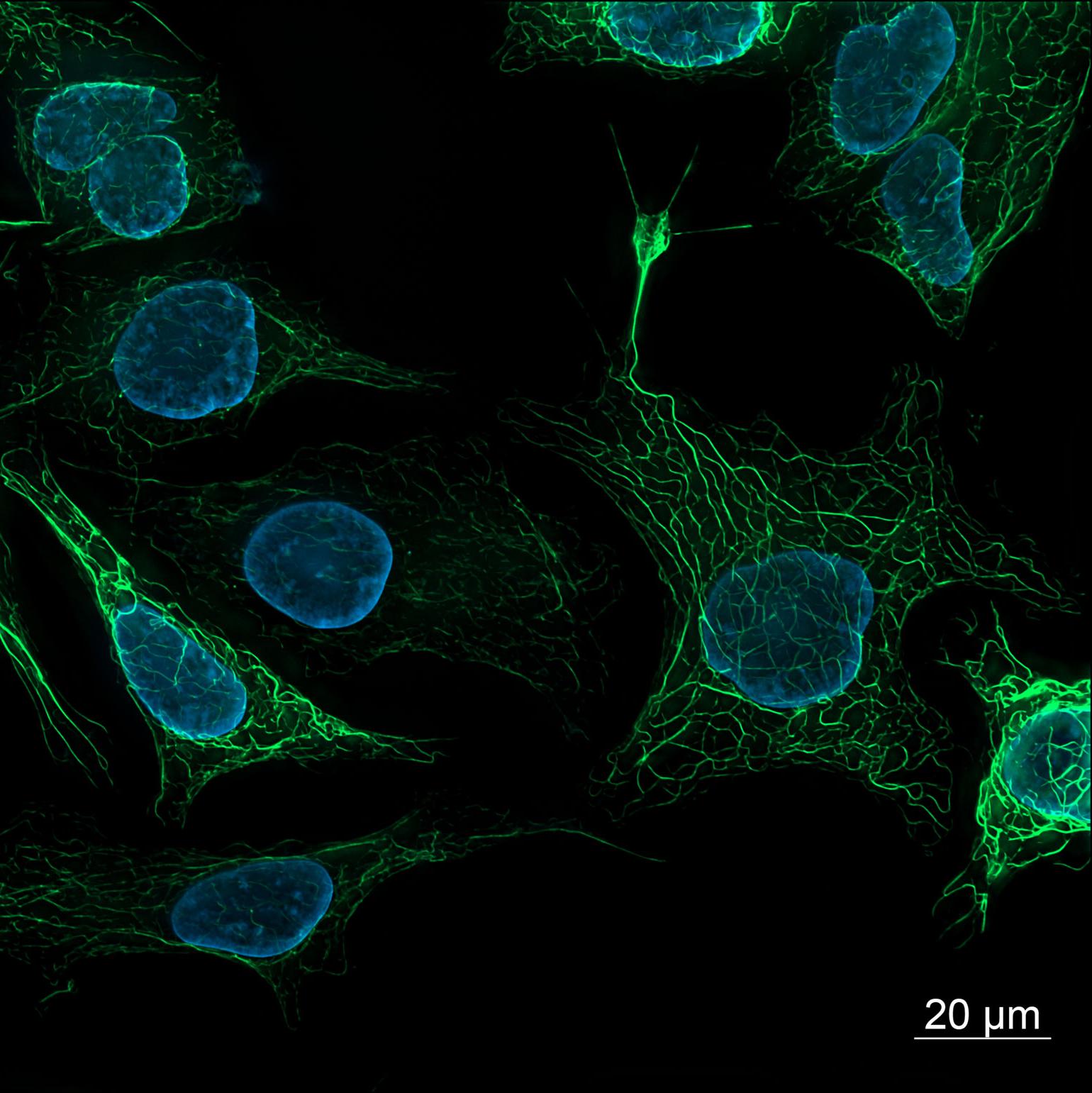 Cellules de souris SK8 K18. Vimentine colorée à Alexa 488 (vert), noyaux colorés à DAPI (bleu).