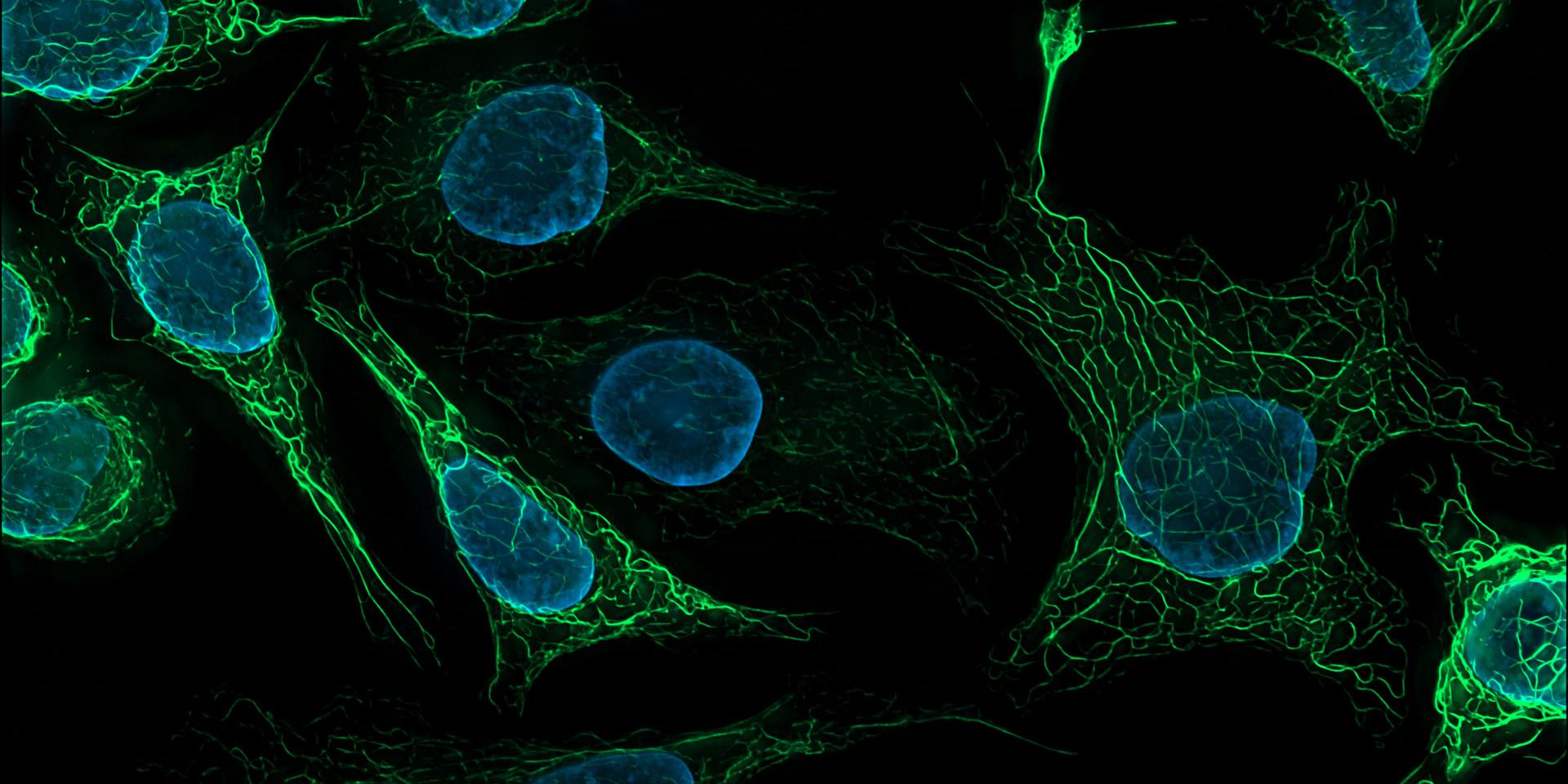 Cellules de souris SK8 K18. Vimentine colorée à Alexa 488 (vert), noyaux colorés à DAPI (bleu).