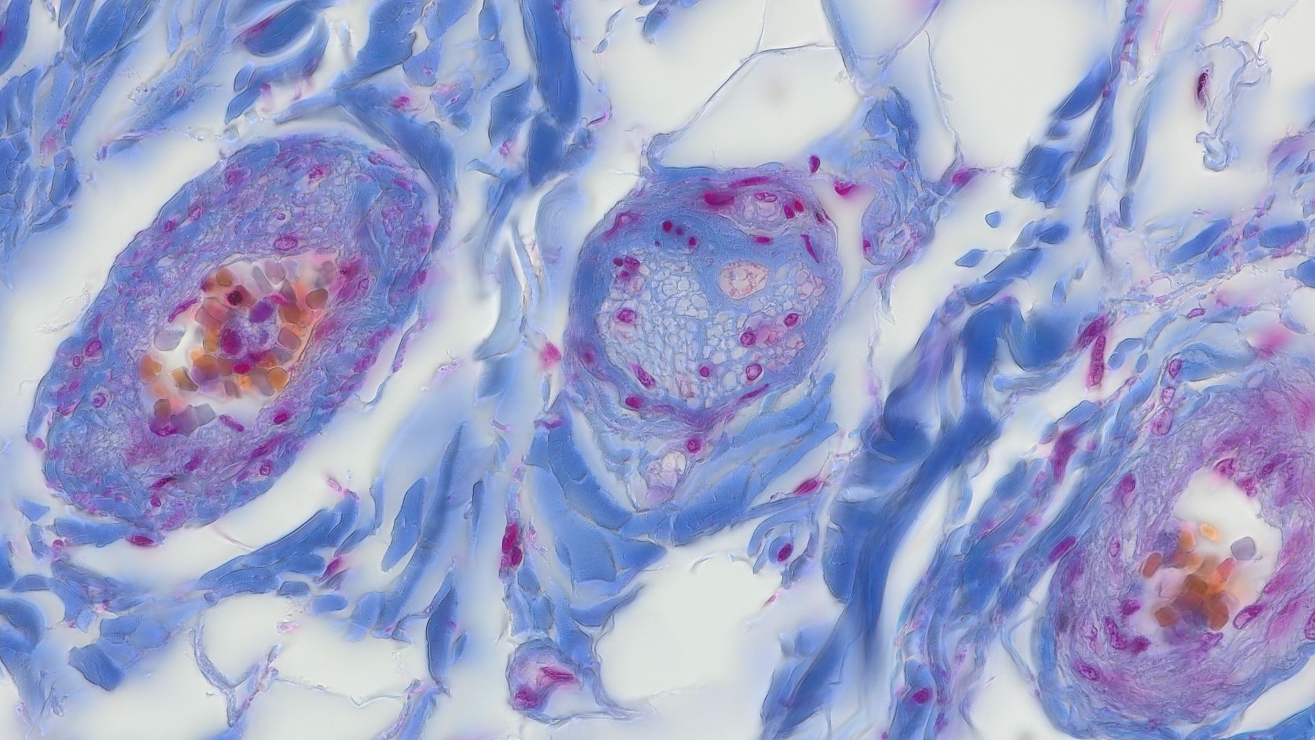 Representative image of peripheral nerve, transmitted light brightfield