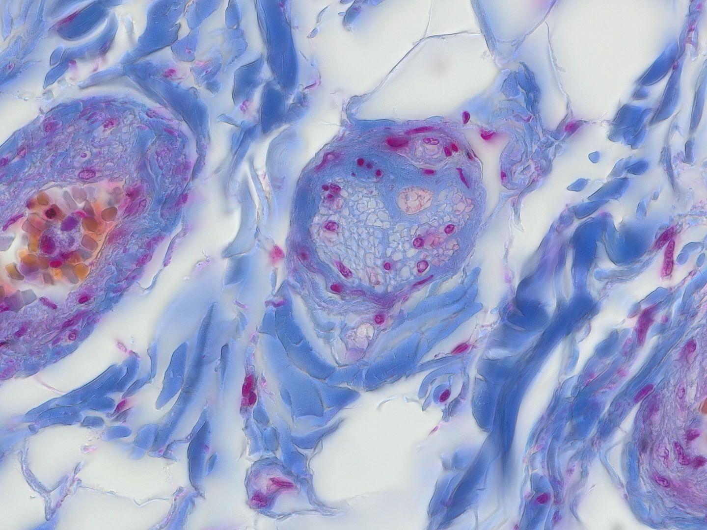Representative image of peripheral nerve, transmitted light brightfield