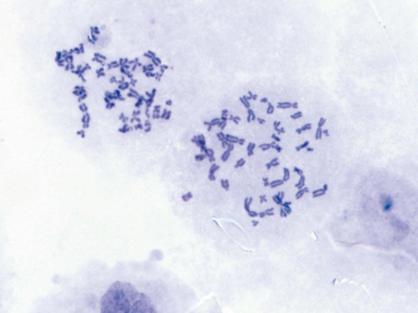 Spécimen de chromosome (humain) 