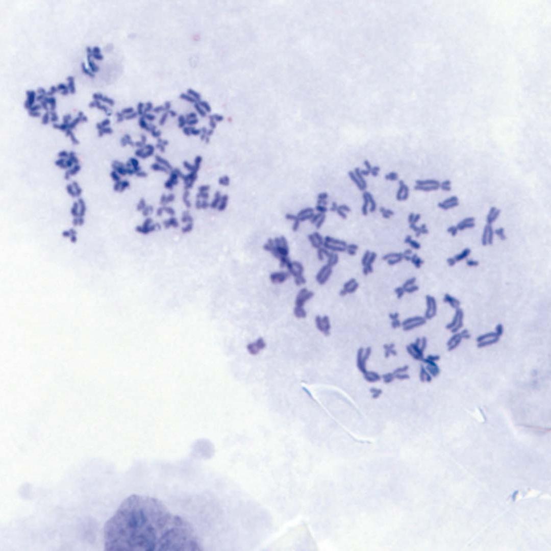 Chromosome specimen (human)