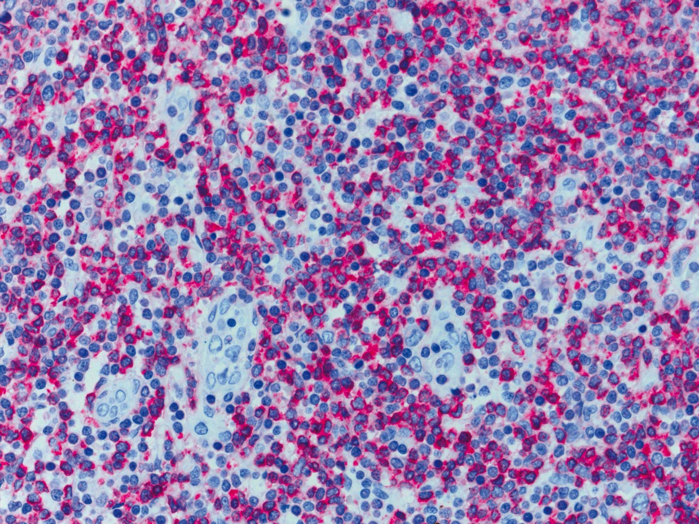 Coupe histologique humaine observée au ZEISS Axioscope 5