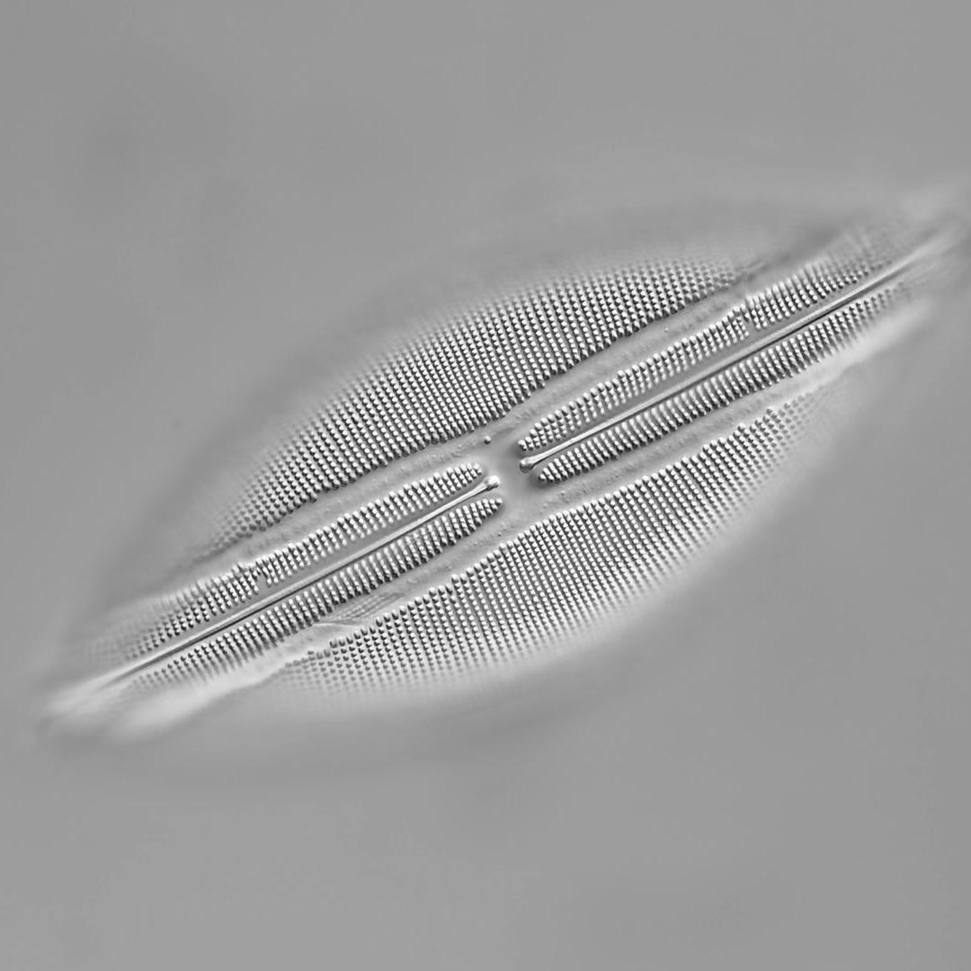 珪藻（Navicula Lyra）