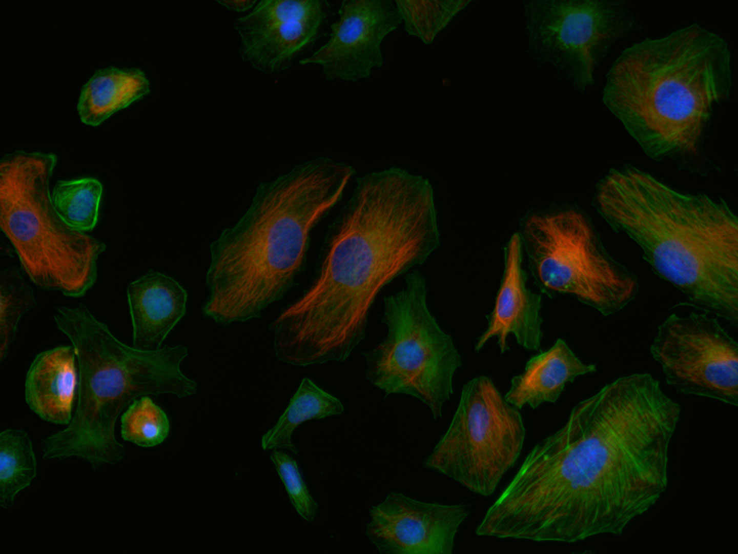 Nerz-Endometrium, Epithelzellen 