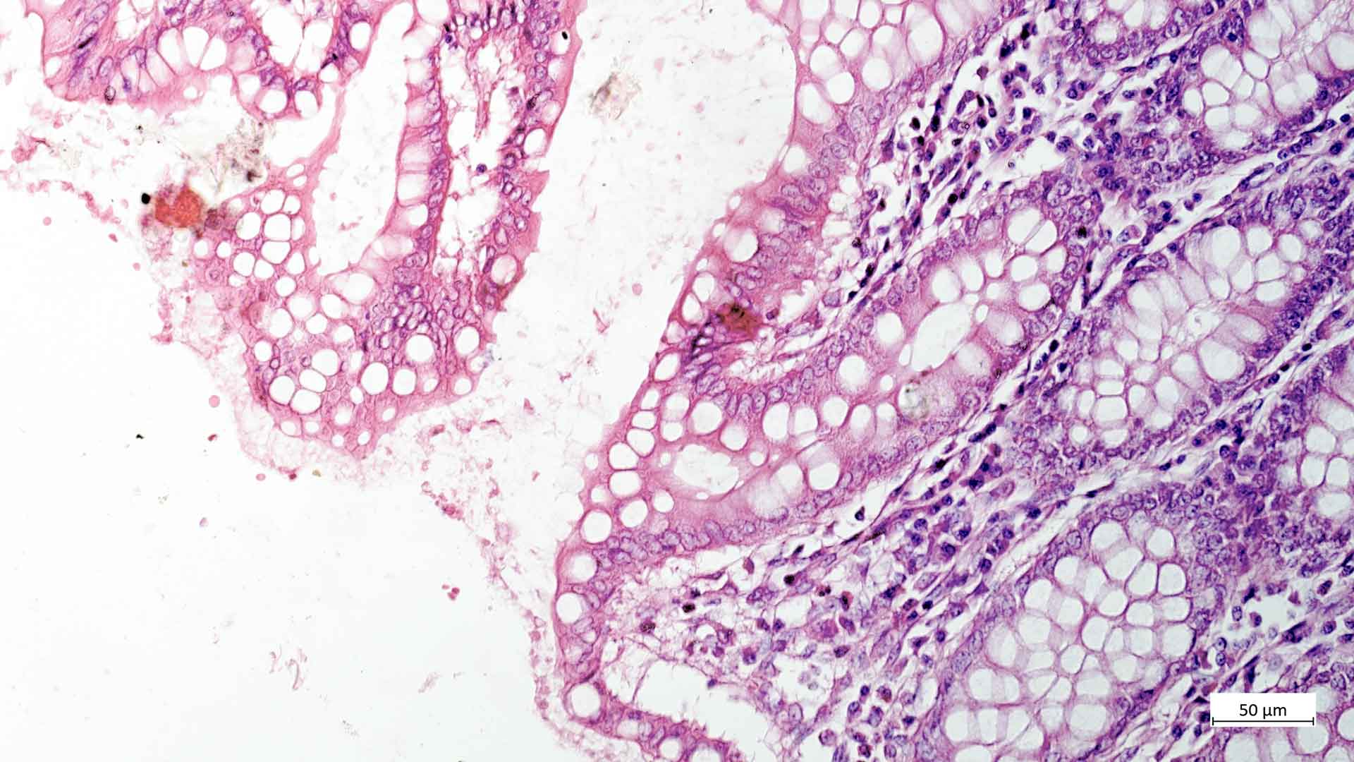 Tejido renal (humano) 