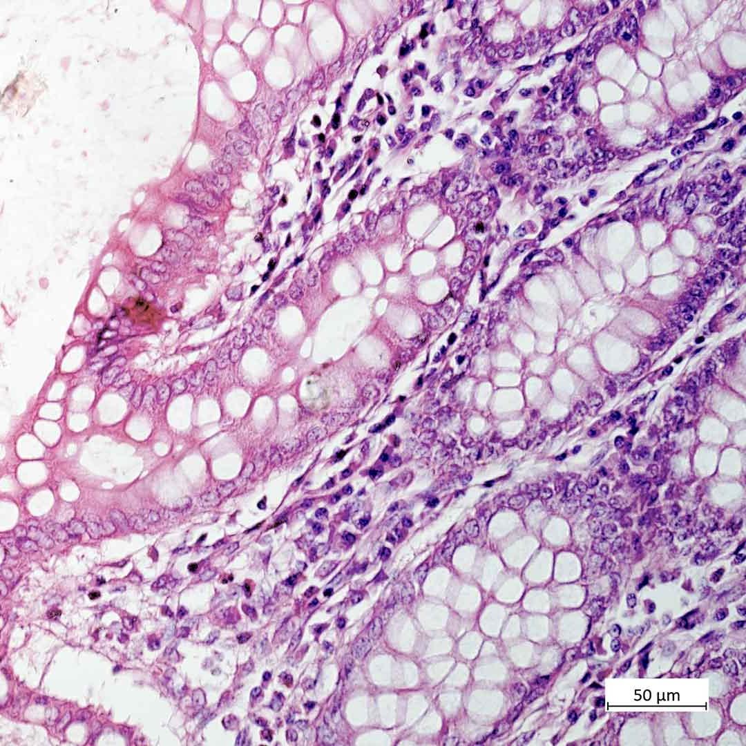 Intestino, tinción HE, contraste de campo claro