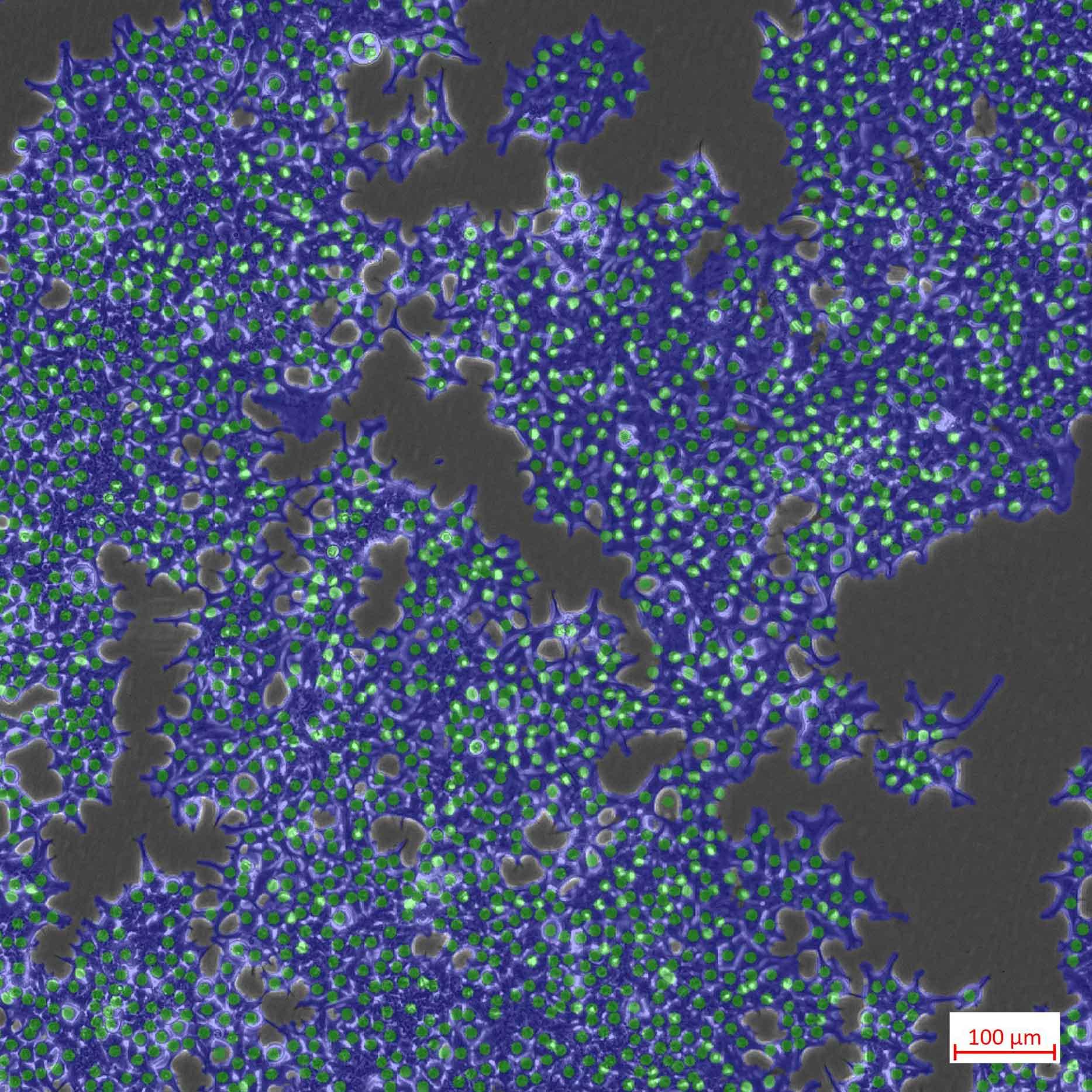 細胞数とコンフルエント率測定のためのLabscopeモジュールAI Cell countおよびAI Cell Confluency