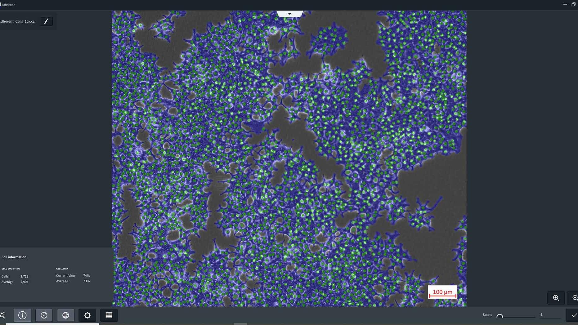 Labscope module for Cell counting and cell confluency. AI Cell count, AI Cell confluency