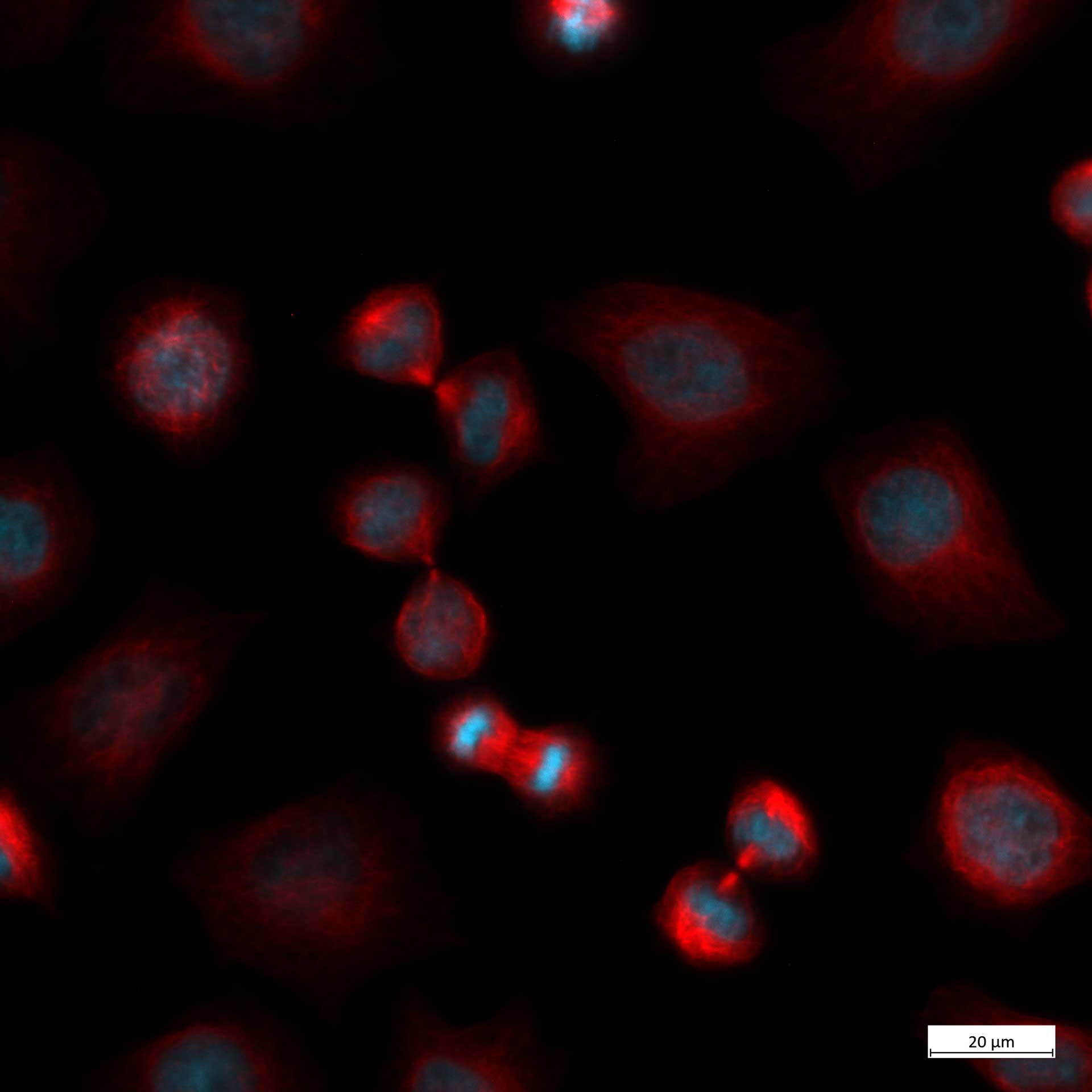 Lignée cellulaire HeLa Kyoto, acquise avec Axiovert 5 en contraste de fluorescence