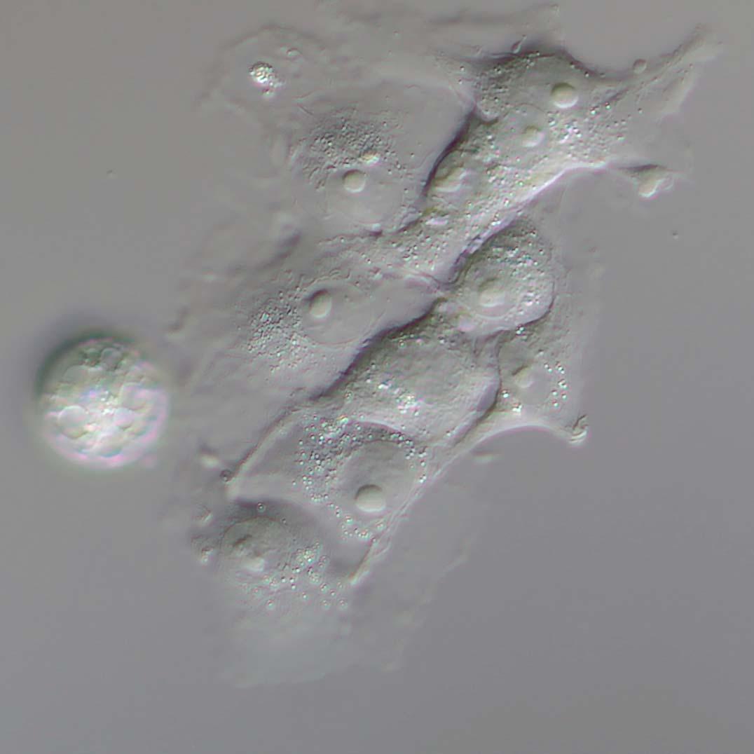 透過光、PlasDIC法で観察した細胞