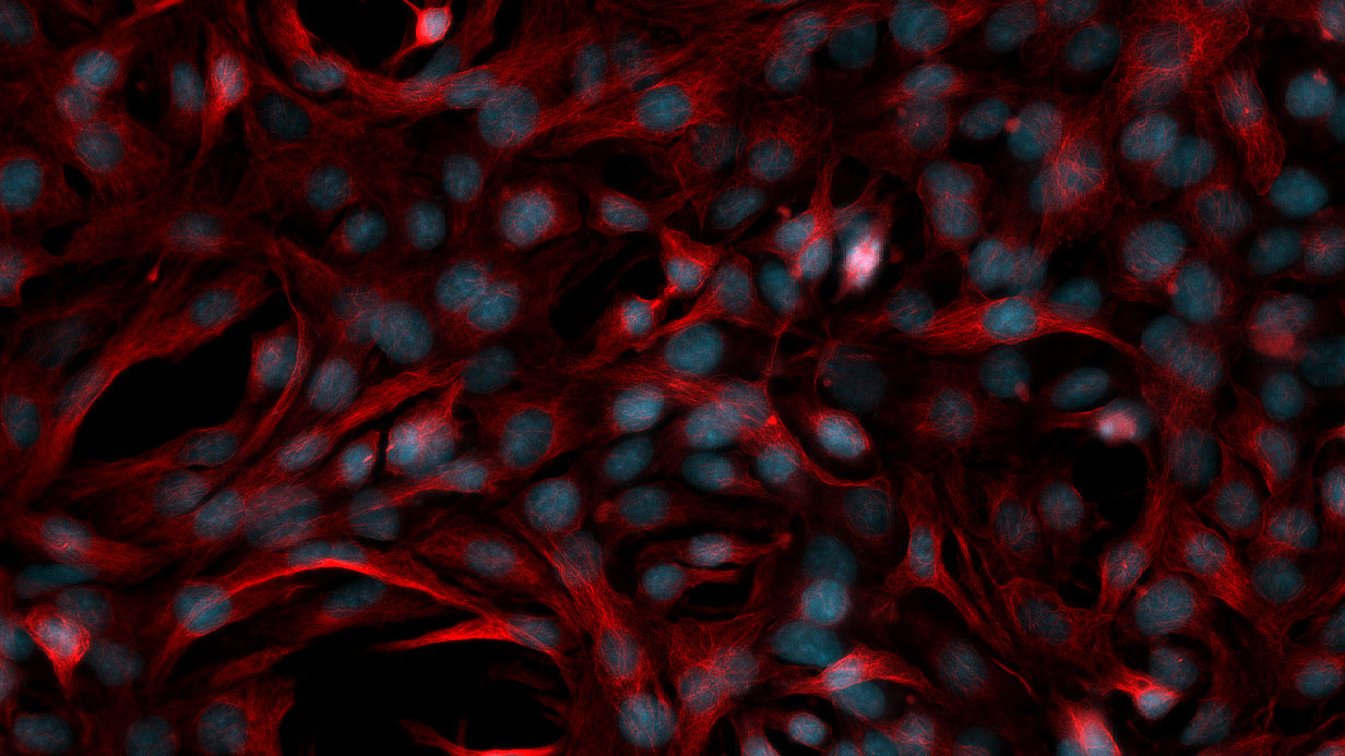 Histologische Probe (human) 