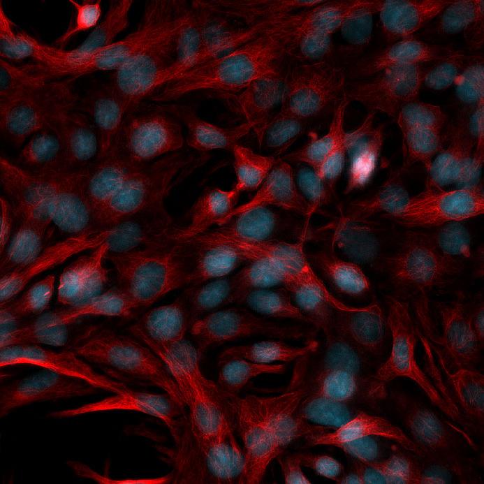 Células HeLa Kyoto, imágenes de fluorescencia multicanal