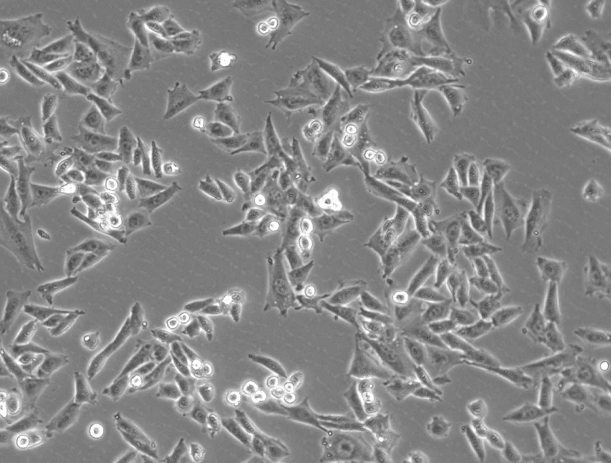 Chromosomenpräparat (human) 