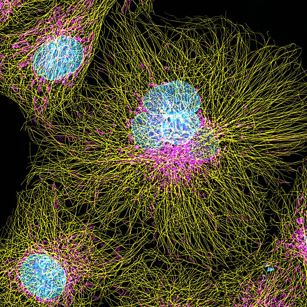 Cellule Cos-7 Tubuline (jaune) et mitochondries (violet).