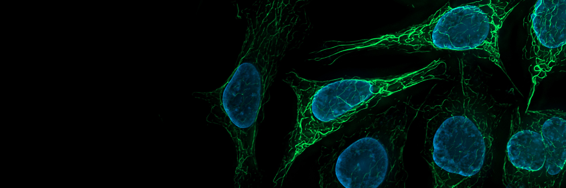 SK8 K18 Mouse Cells. Vimentin stained with Alexa 488 (green), nuclei stained with DAPI (blue).