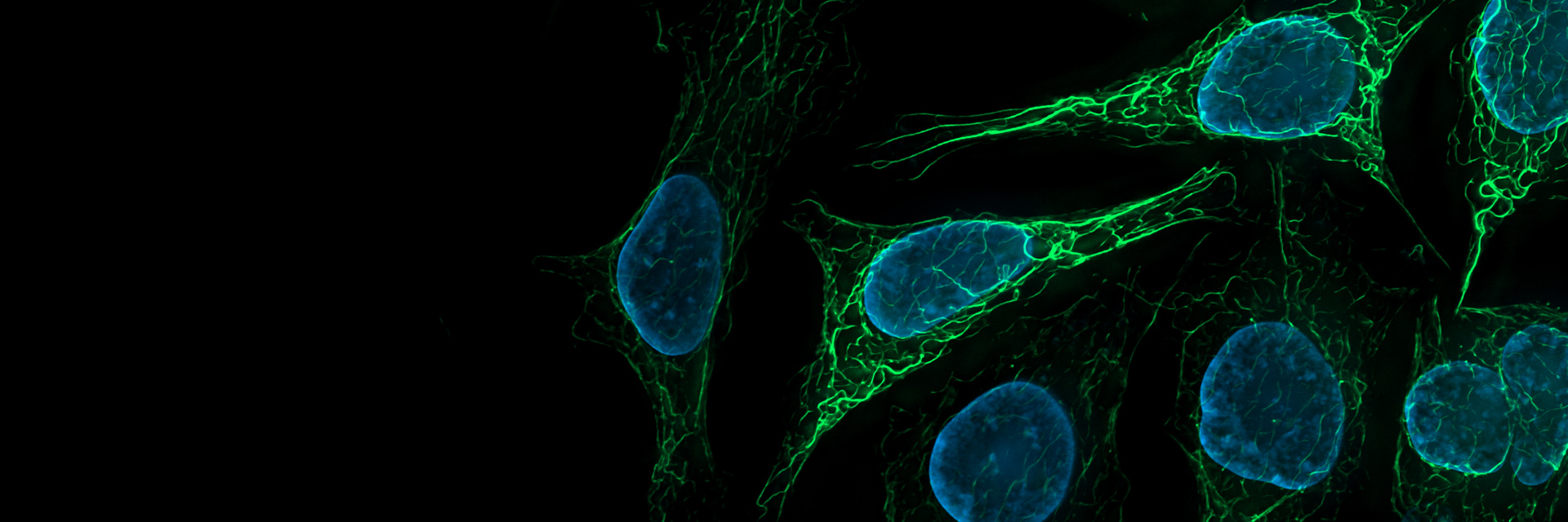 Cellules de souris SK8 K18. Vimentine colorée à Alexa 488 (vert), noyaux colorés à DAPI (bleu).