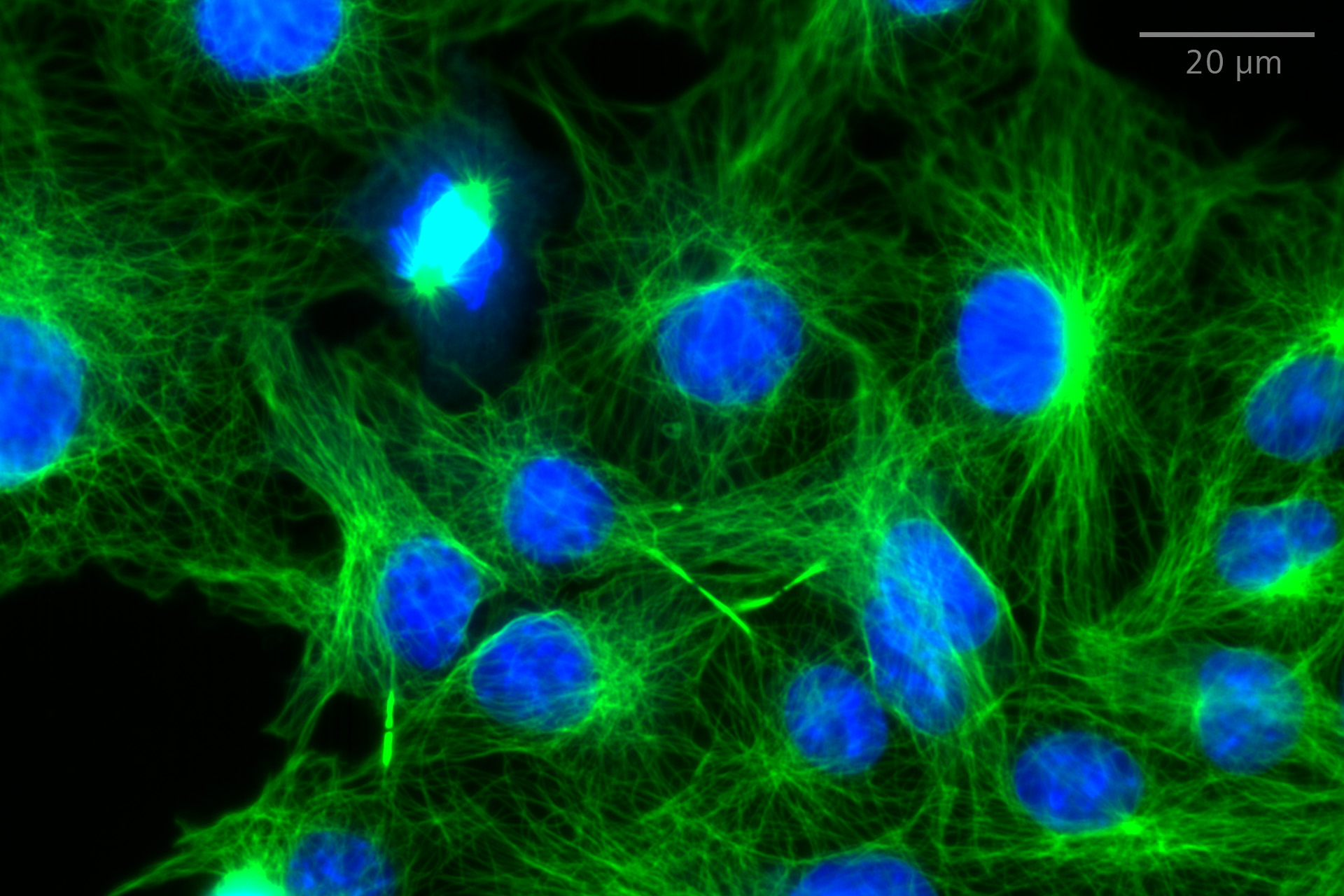 SIM² Apotome：ワイドフィールドとSIM² ApotomeによるCOS-7細胞の単一平面画像を比較。微小管（anti-alpha-tubulin Alexa Fluor 488、緑）、核（Hoechst、青）。対物レンズ：LD LCI Plan-Apochromat 25x / 0.8 Imm Corr