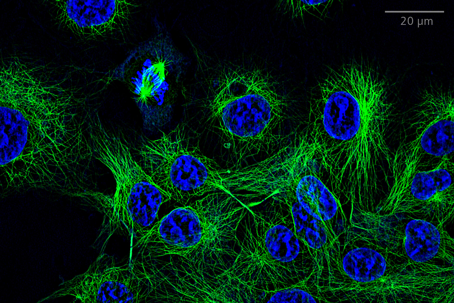 SIM² Apotome : Comparaison d'images en champ large et d'images planes SIM² Apotome de cellules COS-7 colorées pour les microtubules (anti-alpha-tubuline Alexa Fluor 488, vert) et les noyaux (Hoechst, bleu). Objectif : LD LCI Plan-Apochromat 25× / 0,8 Imm Corr.