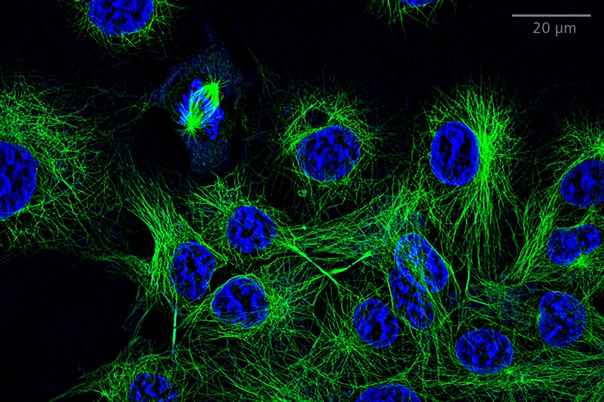 SIM² Apotome: Comparison of widefield and SIM² Apotome single plane images of Cos-7 cells stained for microtubules (anti-alpha-tubulin Alexa Fluor 488, green) and nuclei (Hoechst, blue). Objective: LD LCI Plan-Apochromat 25× / 0.8 Imm Corr