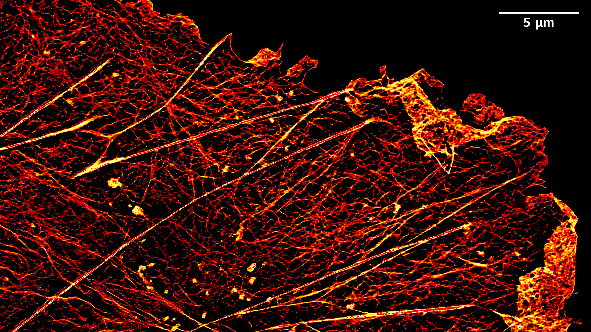 L'image Lattice SIM² des cellules COS-7 marquées à la phalloïdine Alexa 488 a été acquise avec un objectif Plan-Apochromat 100× / 1,57 huile. Projection d'intensité maximale de la pile Z.