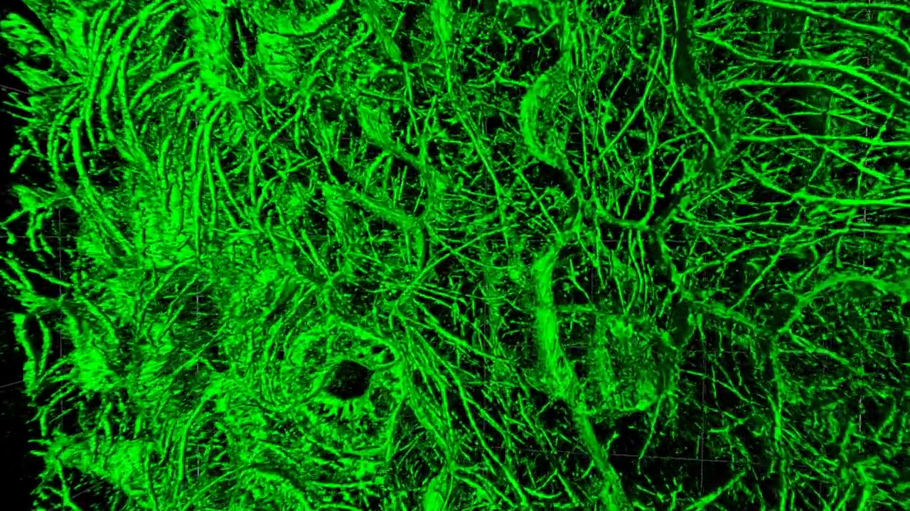SIM² Apotome 3D image of a leaf of a living A. thaliana sample shows the microtubules (Tubulin-GFP) in the upper three cell layers.