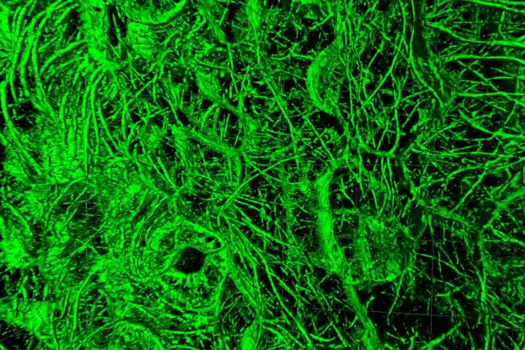 Imagen en 3D de SIM² Apotome de una hoja de una muestra viva de A. thaliana que muestra los microtúbulos (tubulina-GFP) en las tres capas de células superiores. Muestra y datos cortesía de Calder y P. O’Toole (Departamento de Biología y Tecnología de ciencias biológicas, Universidad de York, Reino Unido)