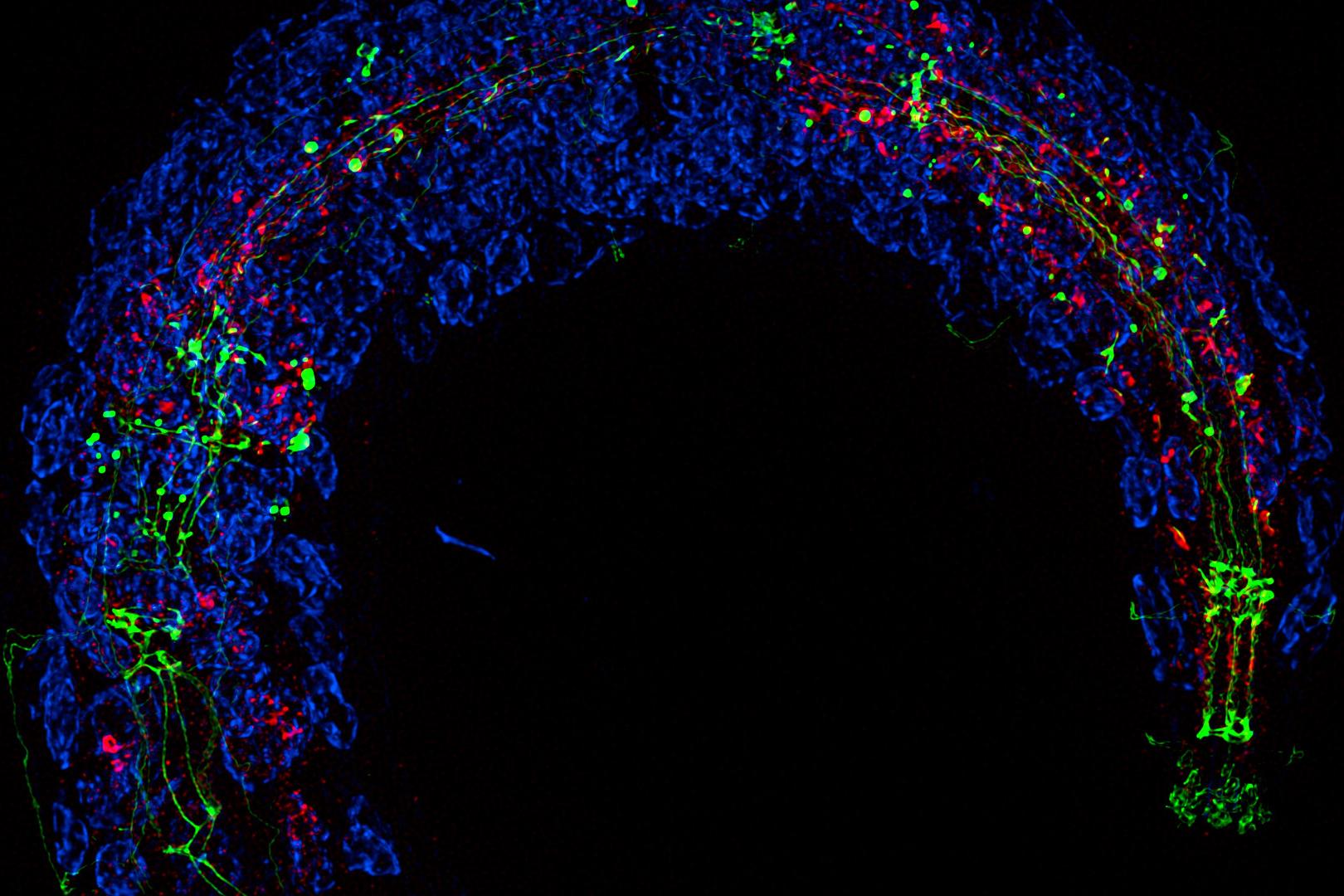 Lattice SIM² 3D-Aufnahme einer C. elegans-Larve 