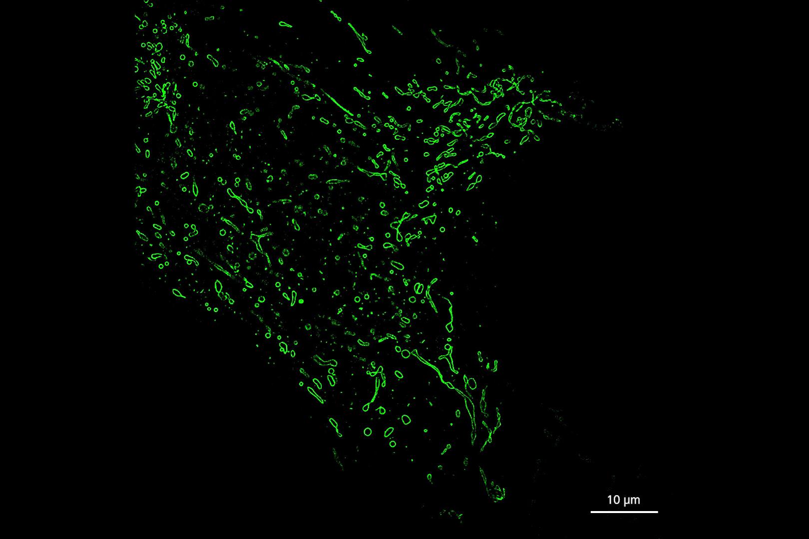 3D-Bild von lebenden, Tomm20-mEmerald exprimierenden U2OS-Zellen mit einer Schrittweite von 110 nm. Objektiv: Plan-Apochromat 63×/1,4 Oil