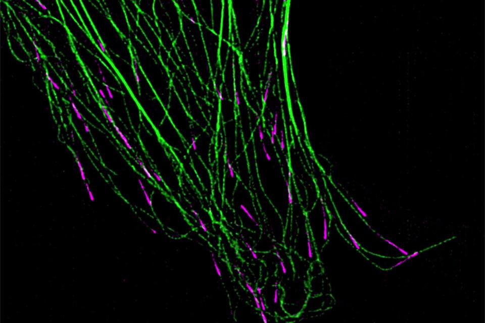 La cellule COS-7 exprimant EMTB-3xGFP (vert) et EB3-tdTomato (magenta) montre un mouvement dynamique des microtubules. Imagerie en Lattice SIM 9 Phase Mode. Objectif : Plan-Apochromat 63× / 1.4 huile
